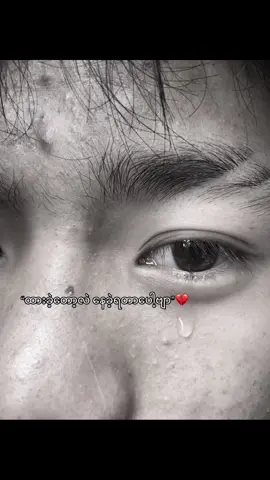 @Noung Noung 💔#fyp #foryou 