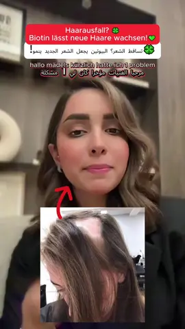 Bruder, kämpfst du immer noch mit Haarausfall durch Testosteron? Probier das mal aus und sag mir, ob’s wirkt! 🎥 #Biotin #HaarausfallVorbeugen #Männerhaarausfall #BlackFriday #VitaminB