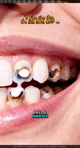 🦷 Sin dentista, sin dolor… ¡solo resultados! ✨#tiktokshop#tiktokmademebuyitt#toothdecay#toothpaste#badbreath 