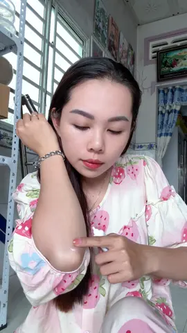 Nhờ bôi kem này mà mấy vết sẹo trên chân cháu em mờ hẳn luôn #kemmoseo #seoloi #seolom #seotham 