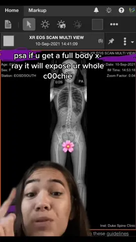 In celebration of X-ray week, I’m reposting X-ray content! 💀🩻 Happy National Radiologic Technology Week!  #xray #xraytech #radtech #radiologictechnologist #xrayweek 