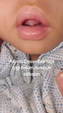 Udah mau setahun, bagaimana iniii😩 #gigibayi #bayitumbuhgigi #fy #fyp 