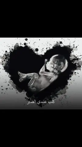 اخافن حسرتي تسر الشماته 💔😔😭#ربي_لاتذرني_فردا_وانت_خير_الوارثين #طال_الانتظار🥺💔 #حلمي_الامومة🥺💔 #متاخرات_بالحمل #مستشفى_كمال_السامرائي 