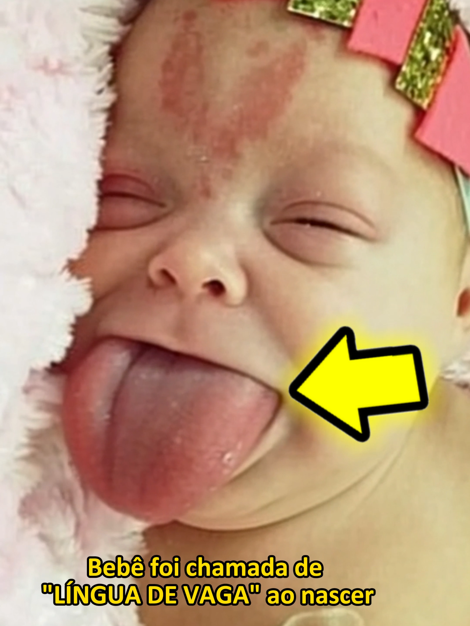 BEBÊ foi chamada de 