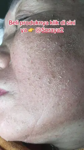 BELI PRODUK DAN KERANJANG KUNINGNYA KLIK DI SINI YA KAK 👉 @Soraya2 