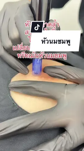 เปลี่ยนจุกคล้ำ ให้เป็นจุกอมชมพูได้ #ผลลัพธ์แตกต่างกันออกไป ตามพื้นฐานเดิม #นุ้ยคิ้วสวยนครปฐม #สักปานนม #ทรีทเม้นหัวนมชมพู