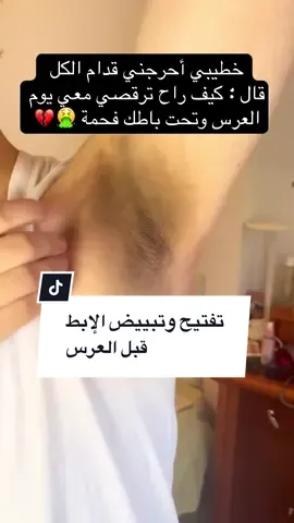 خطيبي أحرجني قدام الكل قال كيف راح ترقصي معي وتحت باطك فحمة 🤮#وصفات_طبيعية #explore #fyppp #تبييض #تفتيح 