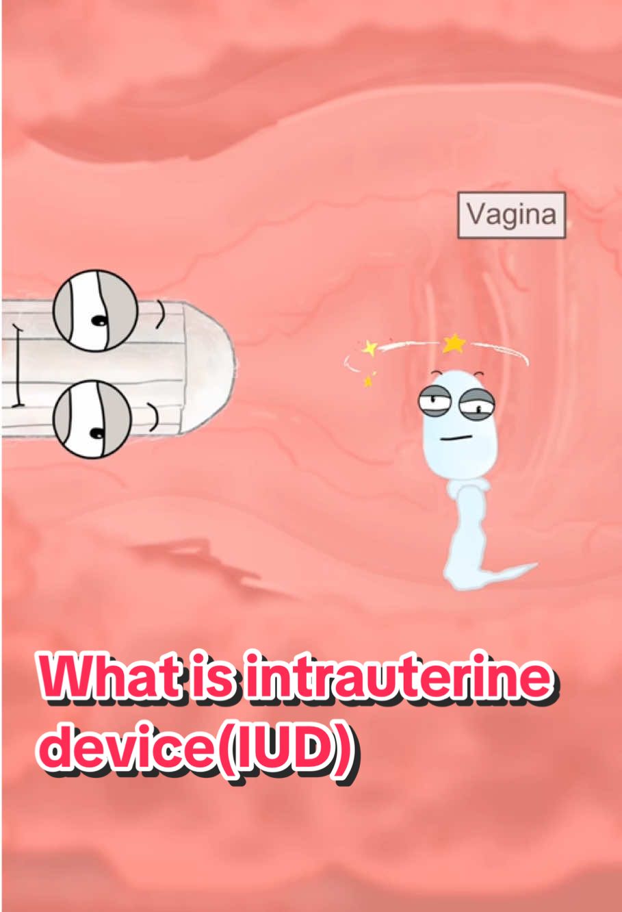 What is intrauterine device(IUD)🧐🧐🫣😳#healthy #animation 