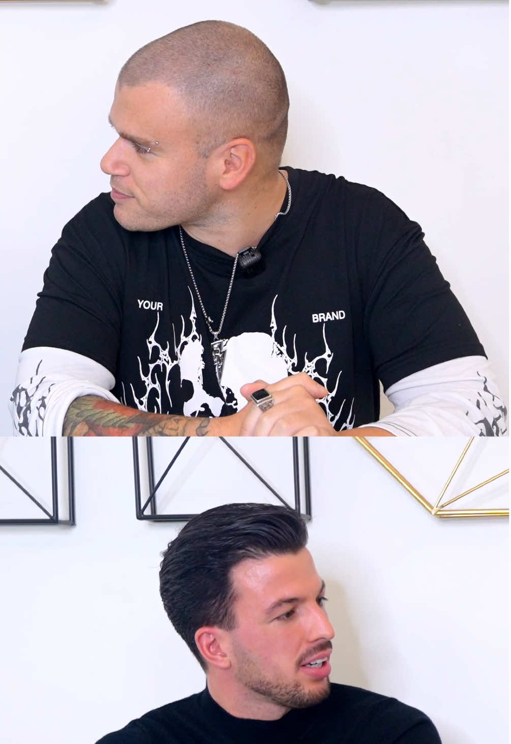 la calvizie di Jacopo iPantellas #alopeciaandrogenetica #calvizie #capelli #ipantellas #ettorecasolincapelli