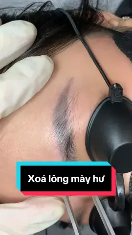 Đưa lông mày hỏng đến với em đi ạ.