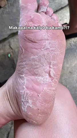malamboooot na ulit syaaa😍🥹 #footmask #lanbenafootmask #footpeelmask #removecalluses 