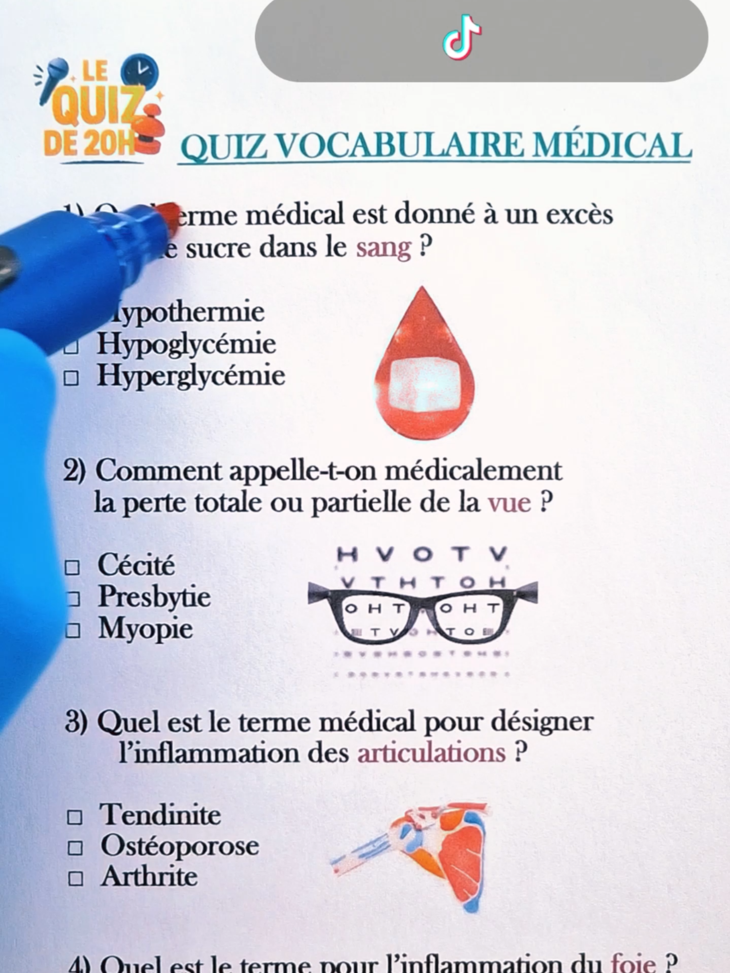 Quiz Vocabulaire Médical Dis moi ton score / 7 #quiz #quizmedical #quizscience #France #iq #vocabulaire #question #connaissance #Quizz