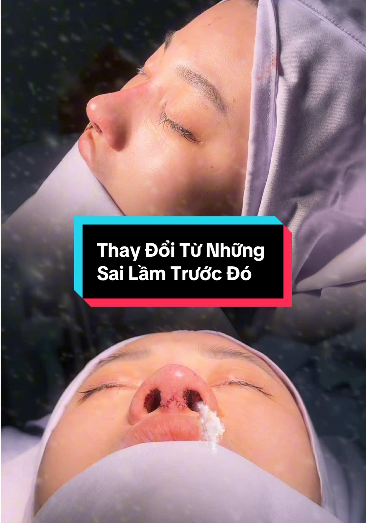 #ilovetiktok #results #facechange 