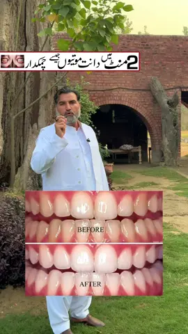 Romax charcoal teeth whitening powder #teeth #unfrezzmyaccount #foryoupage #fyp 