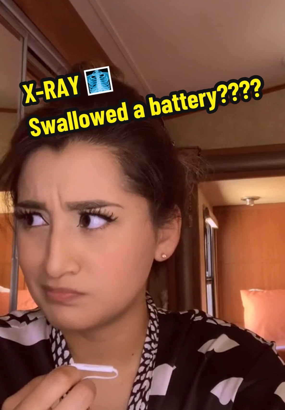 In celebration of X-ray week, I’m reposting X-ray content! 💀🩻 Happy National Radiologic Technology Week!  #xray #xraytech #radtech #radiologictechnologist #xrayweek 