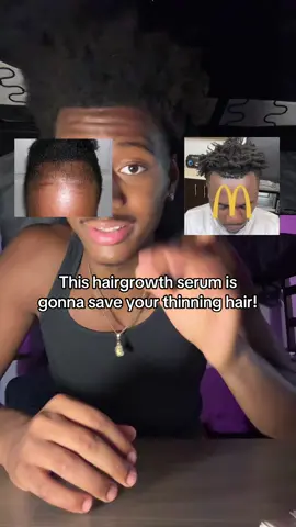 It’s proven to work and it saved me a lot of money😅! #hairgrowth #bebodywise #tiktokmademebuyit #hairgrowthtips #tiktokshopblackfriday 