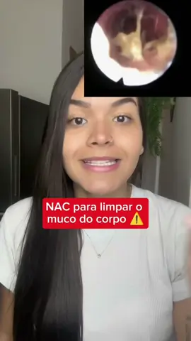 #nac #nacetilcisteina #muco #mucolitico 