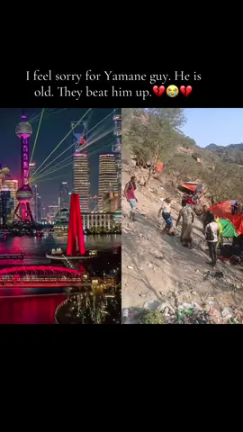 #duet with @T V S 🇨🇦 v.s 🇪🇹የቅመሞቺ ወንድም 