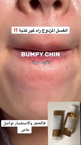 #للحجز والاستفسار تواصل خاص  غسول سينتيلا الرغوي يحتوي على مستخلص نبات السنتيلا (Centella Asiatica) من مدغشقر. 	•	يرطب البشرة وينظفها بلطف بدون ما يسبب جفاف. 	•	يهدّئ البشرة الحساسة ويخفف الاحمرار. غسول سنتيلا الزيتي غسول خفيف يعتمد على الزيت يذيب بلطف المكياج، الأوساخ، الزيوت، وواقي الشمس دون أن يسبب أي حرقان في منطقة العين. يحتوي على زيت السينتيلا و6 زيوت نباتية .