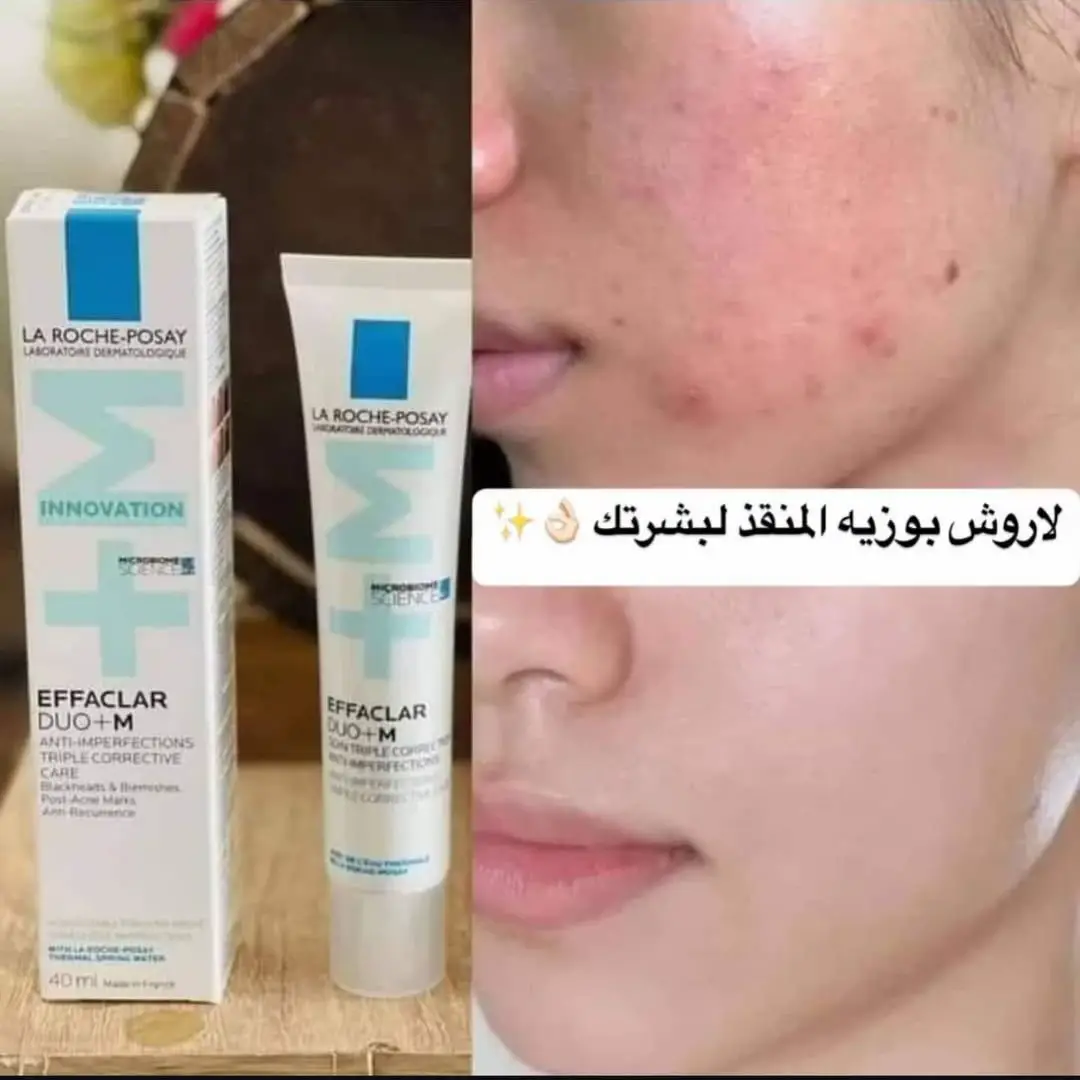 كلة أصلي 🙈❗️