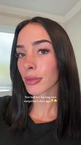 Some lashes and self tan freckles will save meeee every time lol  #surgery #relatable #viralvideo #foryoupage 