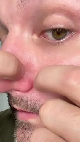 This is the peel shot works wonders! 