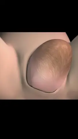 Comment se déroule un accouchement par voie basse?