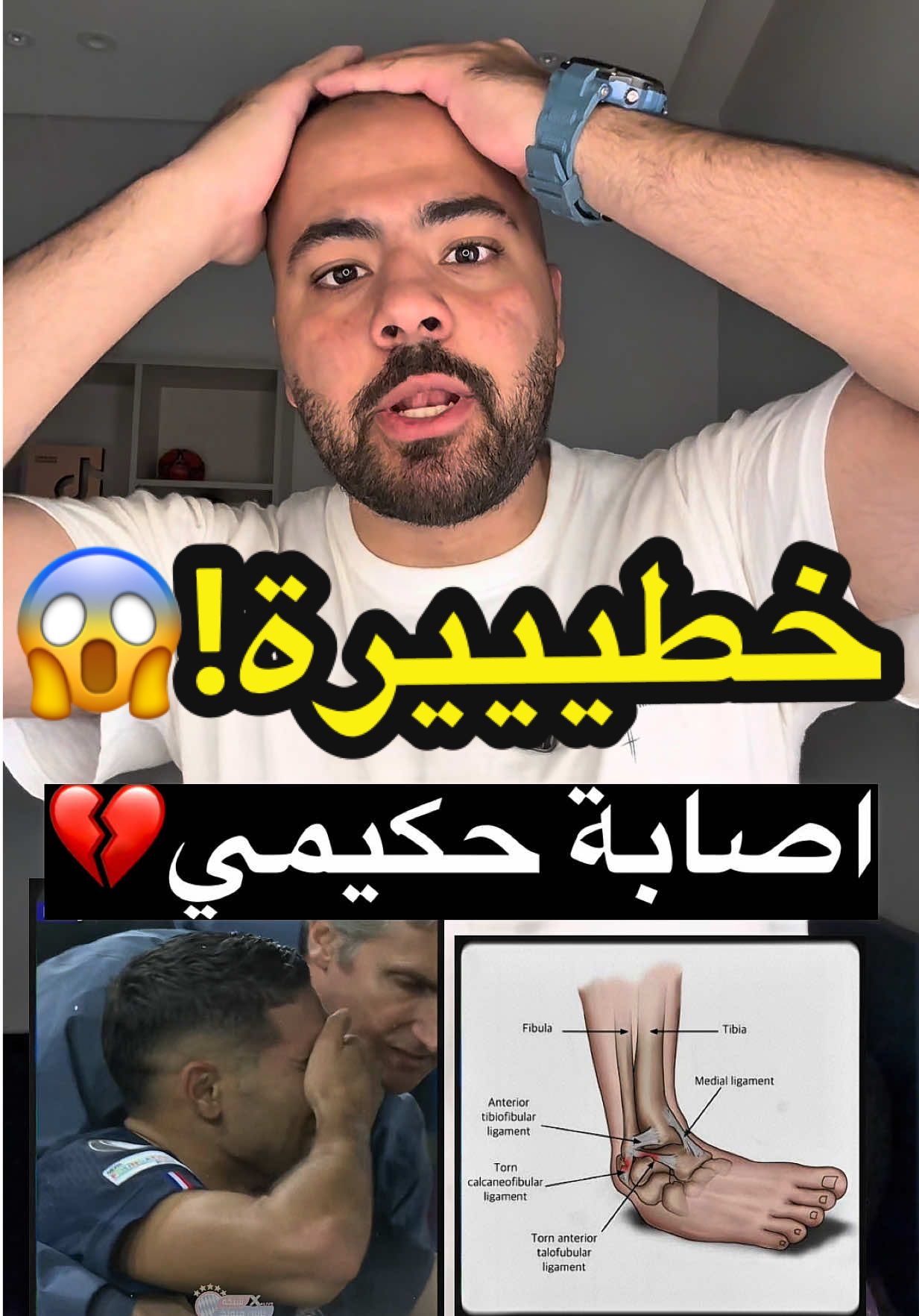 تفاصيل اصابة حكيمي الخطيرة!😱 #sportsontiktok #حكيمي #المغرب🇲🇦 