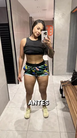 Tratando o lipedema , já foram 12,800 kg off  #lipedema #monjaro #tizerpatida #Fitness #motivation 