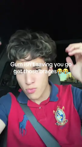 Can’t believe yall believed me #fyp #overbite #looksmax 