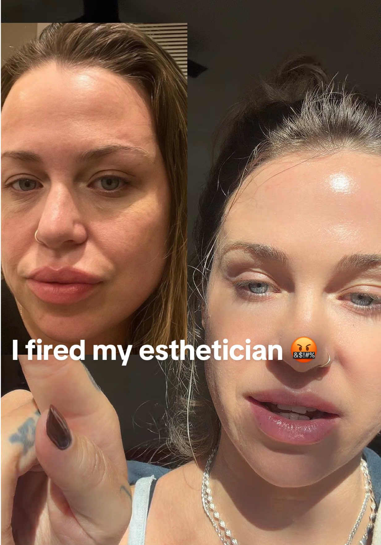 These were the missing piece! #womenover30 #antiagingskincare #drmtlgy #growthfactors #womenover40 