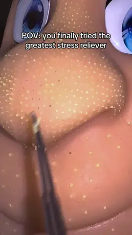Best stress reliever #asmr #oddlysatisfyingvideo #relax #satisfying #pimplepopping 