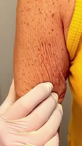 #cuidadoscomapele #autocuidado #belezanatural #peleperfeita #skincare 