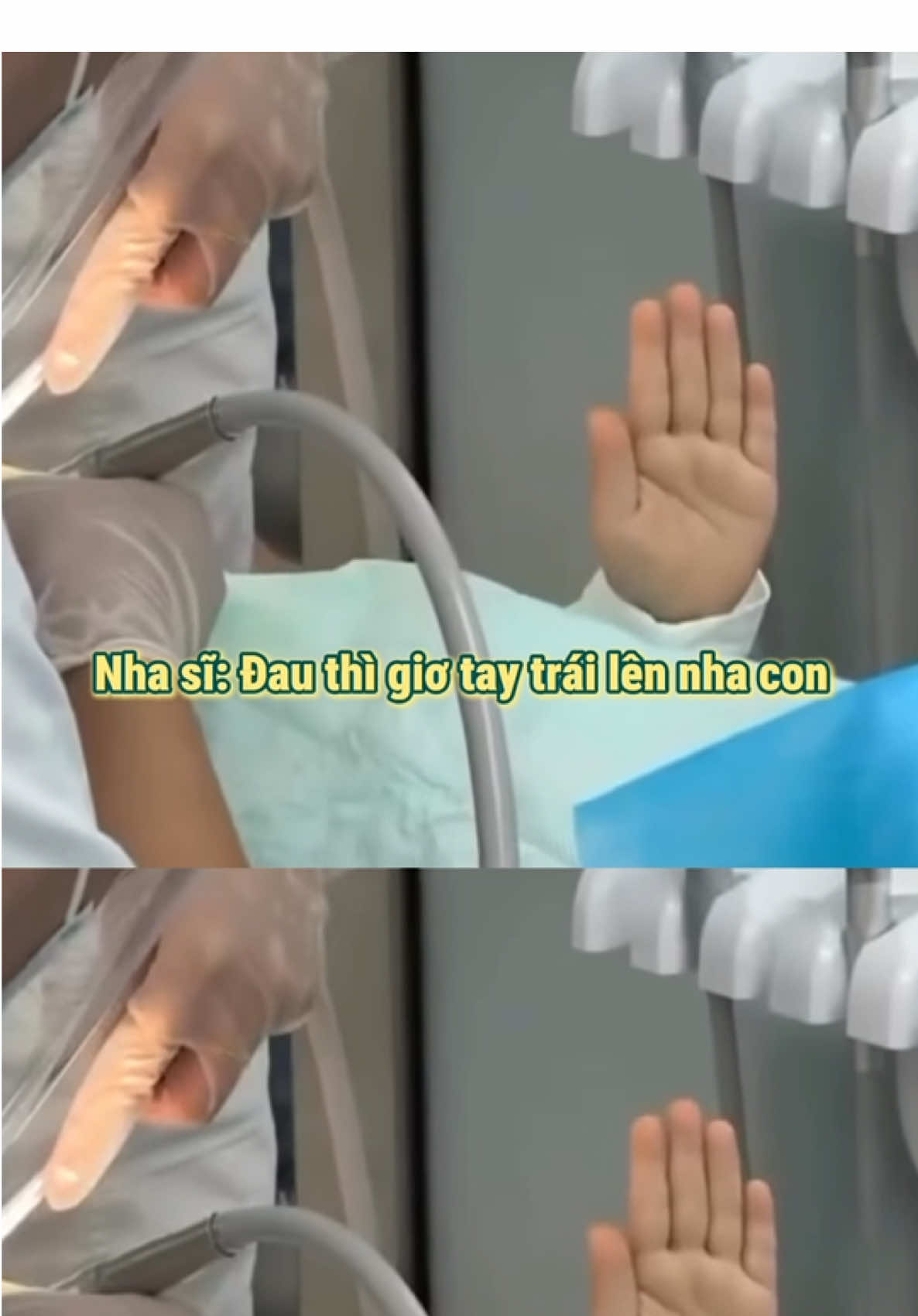 Bác chưa từng hỏi con mún hay k mà 🥹 #viral #xuhuong #xh #niềng #trending 