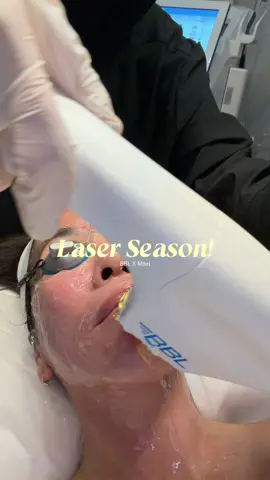 It’s laser season ✨ and I’m back at @AMC Laser Lounge for my second session of BBL and Moxi! BBL, or BroadBand Light, is a light-based treatment that targets different skin concerns using customized filters. For my session, my provider used 4 filters: 1️⃣ Anti-aging – boosts collagen and improves overall skin tone 2️⃣ Redness – reduces broken capillaries and calms inflammation 3️⃣ Hyperpigmentation – targets dark spots and sun damage 4️⃣ Photo finish – gives that polished, radiant glow There’s zero pain with BBL — just a gentle warmth from the light pulses. Then we moved on to Moxi, which is a non-ablative fractional laser that helps with texture, fine lines, and tone. We went stronger this time with 5 passes, but pain was only around a 3 near the jawline and 1–2 everywhere else. What’s most surprising to me is how much of a difference these two lighter treatments have made in my skin compared to the more aggressive lasers I’ve done in the past. My complexion looks brighter, smoother, and more even — and with minimal downtime. I’ll be back in a month for my third session to keep building on these results 🤍 #BBL #MoxiLaser #lasertreatments #skintreatment #hyperpigmentation 