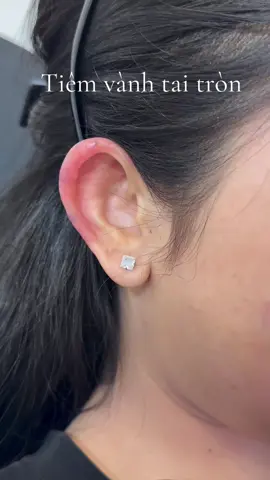 Bạn không thích tai vểnh thì có thể tiêm vành tai tròn, tự nhiên, đeo khuyên cũng rất đẹp  #filler #taivenhtrunghoa #beauty #lamdep 