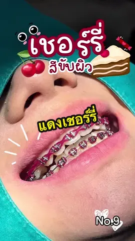 แดงเชอร์รี่🍒🧁 เปิดทำการ10.00-20.00น.(หยุดทุกวันพุธ) โทร:080-462-5652 Line:@daisysmilekorat (https://page.line.me/daisysmilekorat) FB:คลินิกทันตกรรมเดซี่สไมล์ ทำฟัน จัดฟัน โคราช Daisy Smile dental clinic Tiktok:daisysmile_korat Youtube:คลินิกทันตกรรมเดซี่สไมล์ #d#daisysmiledentalclinicค#คลินิกทันตกรรมเดซี่สไมล์ำฟันโคราช#ทําฟันโคราชช #ทำฟันจัดฟัน        