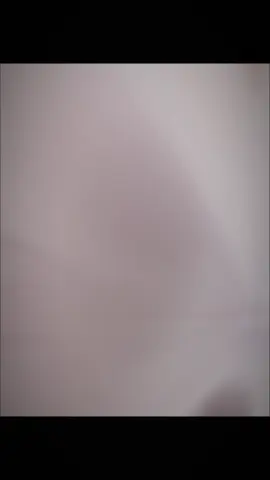 em yeu anh hon the.. #chiyeuminhanh  #viral #xhtiktok #xhggggg🐰 