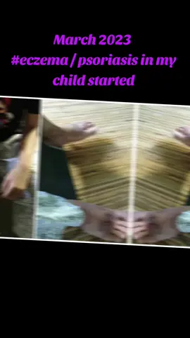 This is a story about my son.  In March 2023  #eczema / psoriasis in my child started.  Initial treatment with steroids really healed quickly but when the medicine ran out, the inflammation on the skin was worse than before.  The moisturizing cream was even bottled but the wound did not dry or heal.  Other methods of treatment (treating the gut). Take care of his diet and eat everything organic (local chicken), but the recovery is too slow and revert back once he eat processed food.  Back in June 2024,  I started trying BE products (#shiruto, #spirulina and aulora socks)  Alhamdulillah Internal recovery is faster if the diet continues to be maintained and functional foods are taken consistently. External recovery with #IPPA1cream helps skin heal better.  Now in 2025, no more serious eczema problems, keep taking Shiruto - to strengthen immunity and Spirulina - to maintain sufficient nutrition to stay healthy  Pm 0168850821 if interested to try or want to know more. #BEInternational 