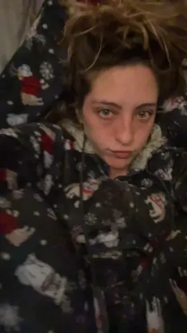 Pretzel girl vibes in my onzie 🥨