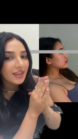 A snatched side profile, results speak for themselves  Disclaimer  At Diana’s Beauty Lab we provide consultations collagen boosting, tissue regeneration and other facial treatments  To book:  • Visit dianasbeautylab.com  •  Book for cosmetic consultation for any cosmetic treatments  To find out [how we got these results / how to achieve this look / what products we used / the process] book a cosmetic consultation with our clinic, or contact us via [DM, message, call]. This content is copyrighted and owned by DBL. It is unlawful to reproduce this content, without written approval from DBL. MEDICAL DISCLAIMER: This content is for information and educational purposes only and is not intended to be a substitute for professional individualised medical advice, diagnosis, or treatment. Please book a skin consultation for your individualised concerns. This content and the accompanying music are not persuading or convincing you to undergo any treatment, and it is not “glamourising” cosmetic procedures. This content has been created abiding by the updated cosmetic advertising regulations under the Therapeutic Goods Act 1989. All cosmetic procedures come with risks. A consultation and consent from are required for you to undergo any cosmetic procedure. Individual results vary due to genetics, lifestyle, diet and other factors.   Any information relied on is at your own risk. #foryou #viral #sydney #melb#fyp 