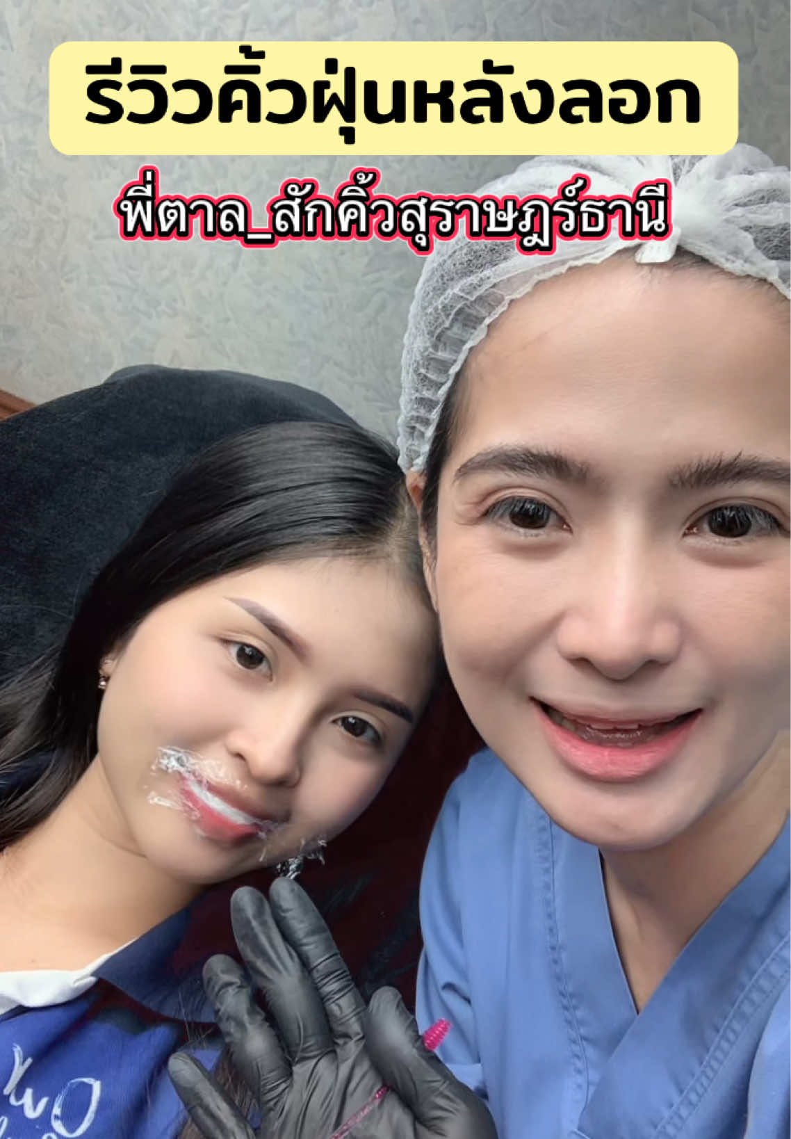 รีวิวคิ้วฝุ่น หลังลอก สีน้ำตาล สวยมาก        #สักคิ้ว #สักคิ้วฝุ่น #สักคิ้วสุราษฎร์ธานี #พี่ตาลสักคิ้วสุราษฎร์ธานี #สักคิ้วออมเบร์ 