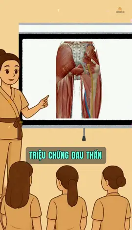 Triệu chứng đ.au th.ần k.inh t.ọa thay đổi theo vị trí rễ th.ần k.inh chịu ảnh hưởng #duongsinh