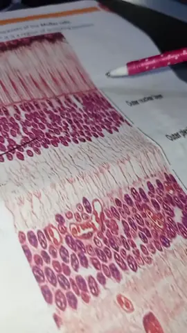 أخيرا عملت على الساوند ده ☝️😂😂