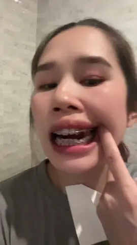 #แปรงชอกฟัน 