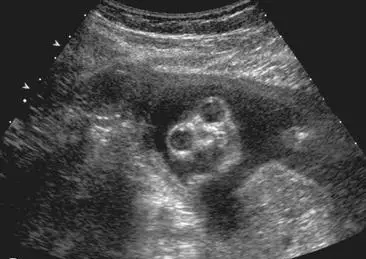 #medicine #medicalstudent #radio #fyp #ultrasoundstudent 