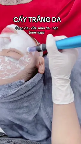 Dịch vụ mùa nào cũng hót luôn nè 🥰🥰#HueBeautySpa #chemicalpeel  #peeltrangda  #caytrangdamat