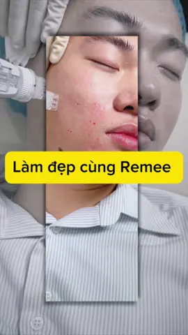 #CapCut làm đẹp với Remee pro 9 