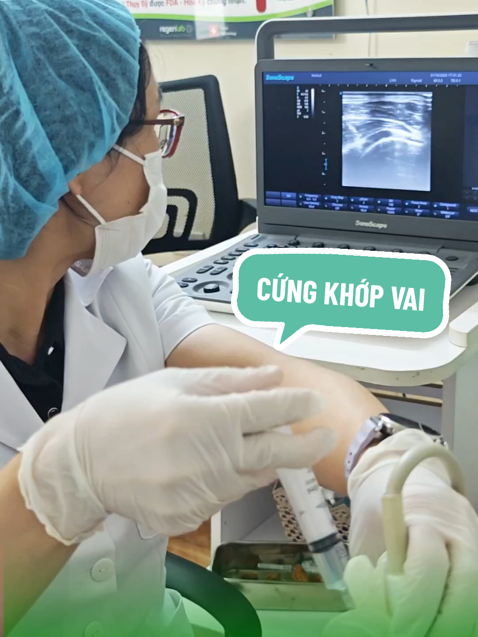 Cách giúp bớt cứng khớp vai khi vận động #dongcungkhopvai #xuhuong 