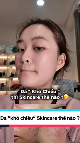 Da “Khó Chiều” mình Skincare thế nào ? #rinavaseoul #trending #numbuzin #numbuzinno1 #numbuzincreamserumno1 